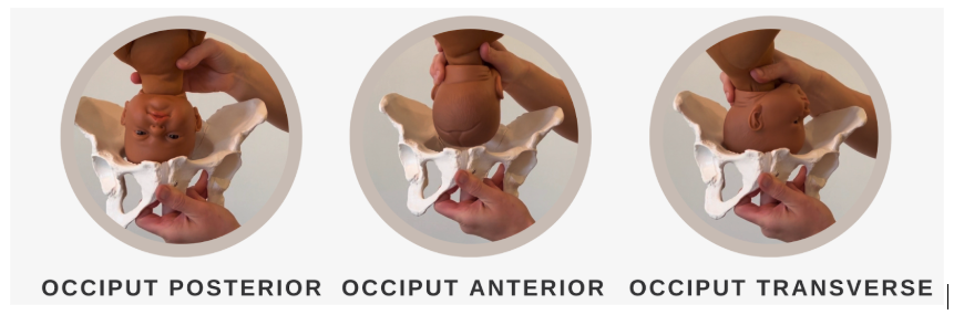 3 fetal positions for labor; OP, OA and OT
